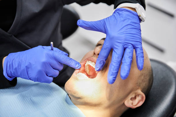 Best Dental Abscess Treatment in Clarkston Heights Vineland, WA