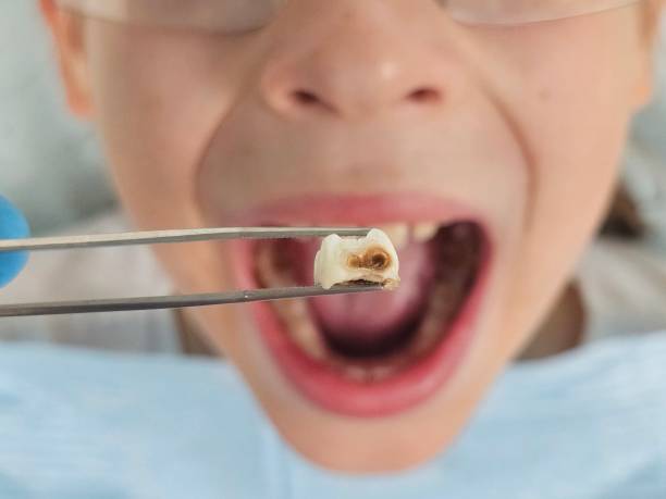 Best Emergency Treatment for Jaw Pain or Injury in Clarkston Heights Vineland, WA